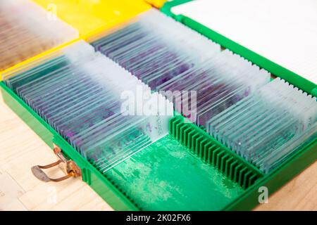 Scatola di vetrini per biopsia tissutale colorati in laboratorio di patologia Foto Stock