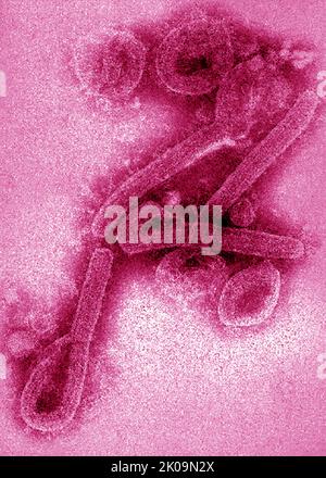 Immagine al microscopio elettronico a trasmissione (TEM) di virioni del virus Marburg. Foto Stock