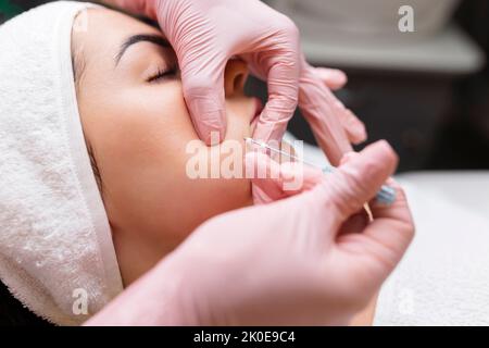 Face Lifting PDO suture Operation. Tecnica innovativa di New thread lift, cosmetologist preparandosi a fare la procedura per il cliente femminile, selezionare il Foto Stock