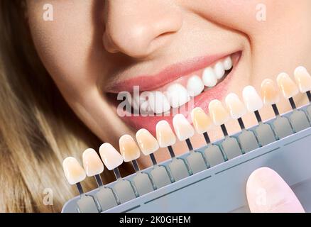 Medico che abbina il colore dei denti del paziente con la tavolozza, primo piano. Odontoiatria cosmetica Foto Stock