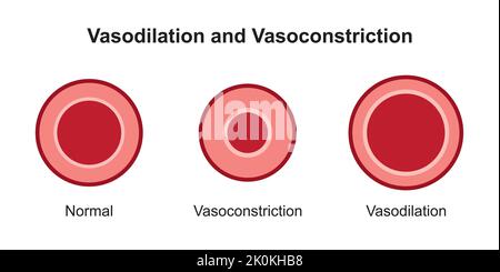 Progettazione scientifica della vasocostrizione arteriosa e della vasodilatazione. Confronto tra vasi sanguigni normali, costrittosi e dilatati. Vettore. Illustrazione Vettoriale