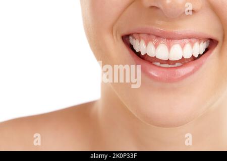 Perfettamente bianco. Primo piano di un giovane donna con un sorriso toothy su uno sfondo bianco. Foto Stock