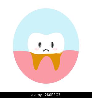 Carie radice dente in stile cartoon piatto. Illustrazione vettoriale del carattere malsano dei denti, concetto di cura dentale, igiene orale Illustrazione Vettoriale
