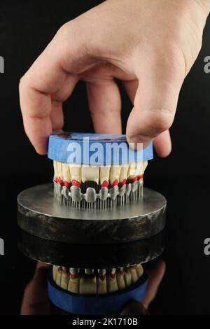 Il dentista controlla il suo lavoro in laboratorio. Corone dentali create su stampante 3D per metallo Foto Stock