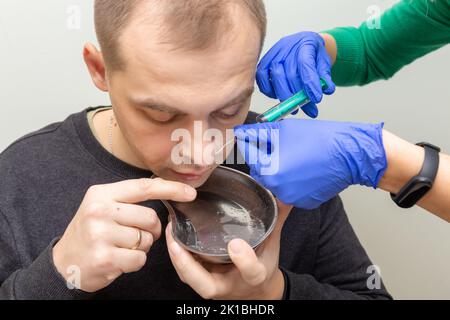 Un infermiere risciacqua la cavità nasale di un paziente affetto da sinusite con soluzione salina utilizzando una siringa. Foto Stock