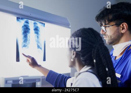 Individuare la fonte di dolore. Shot di un gruppo di chirurghi che discutono di un paziente raggi X durante l'intervento chirurgico. Foto Stock