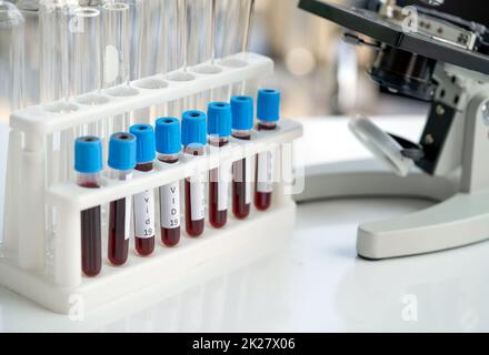 Le provette per il prelievo ematico dei pazienti Covid 19 devono essere posizionate accanto al microscopio su un tavolo da laboratorio bianco. Coronavirus malattia 2019 processo di test in un laboratorio per prevenire la diffusione della ricerca virale. Foto Stock