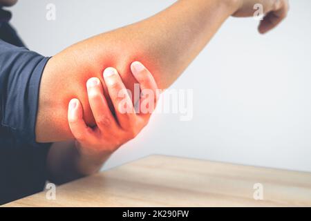 L'uomo è un gomito di dolore. Sulla zona rossa, questi sintomi possono causare da sport, duro lavoro con il braccio. Primo piano con spazio per la copia. Foto Stock