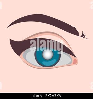 Illustrazione vettoriale della malattia dell'occhio, cataratta del glaucoma e problemi sani della malattia dell'occhio e della nefropatia Foto Stock