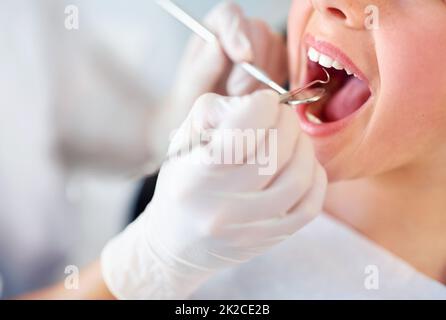 Diamo un'occhiata più da vicino. Closeup shot di una ragazza giovane che ha un controllo al dentista. Foto Stock