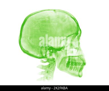 Cranio umano. Immagine radiografica verde su sfondo bianco Foto Stock