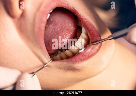 Dentista che esamina i denti Foto Stock