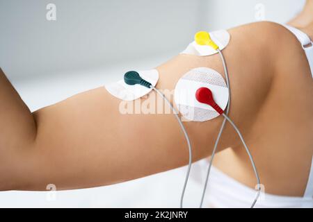 Stimolazione e addestramento del braccio dell'elettrodo. Terapia del dolore Foto Stock