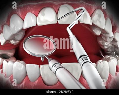 Strumenti professionali per dentisti isolati su sfondo bianco. Illustrazione 3D Foto Stock