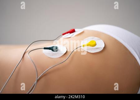 Terapia di stimolazione muscolare degli elettrodi Foto Stock