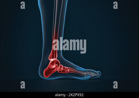 Artrite della caviglia. Raggi X del piede. Vista laterale Foto Stock