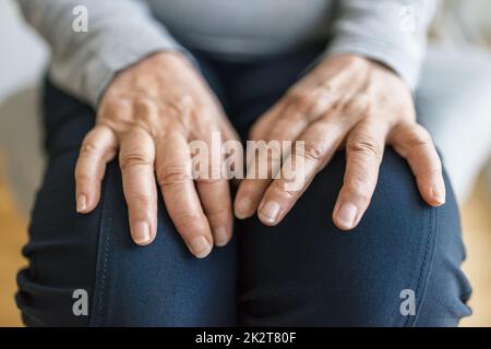 Donna anziana che soffre di artrite Foto Stock