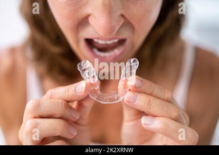 Guardia notturna dentale Aligner trasparente Foto Stock