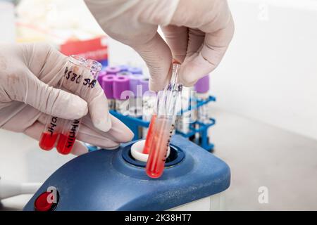 Scienziare utilizzando un vortice per miscelare il contenuto in una provetta. Scienziato che prepara campioni di midollo osseo per l'analisi citometrica a flusso in laboratorio. Foto Stock