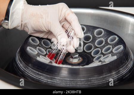 Lo scienziato che colloca alcune provette nella centrifuga. Scienziato che prepara campioni di midollo osseo per l'analisi citometrica a flusso in laboratorio. Foto Stock