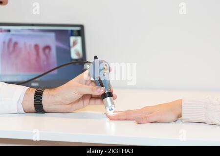 Concetto di diagnosi della sclerosi sistemica, le mani di un medico e di un paziente sono visibili con i macchinari di diagnosi. Foto Stock