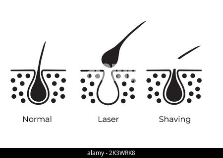 Icone isolate per la rimozione dei peli per normale, rasatura e laser Illustrazione Vettoriale