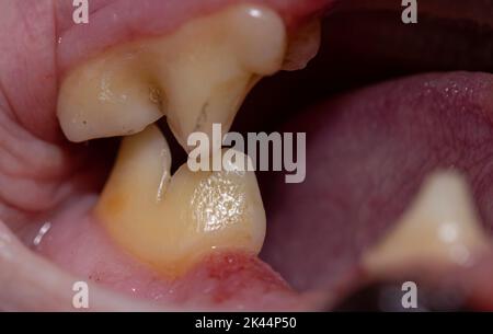 Denti carnassiali della parte superiore e inferiore della mandibola di un gatto felido per esporre la coppia di denti; gengive dentali giovani e ben sviluppate di un piccolo gatto selvatico Foto Stock