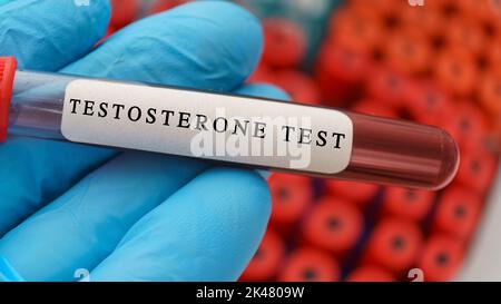 Test del sangue di testosterone, immagine concettuale Foto Stock