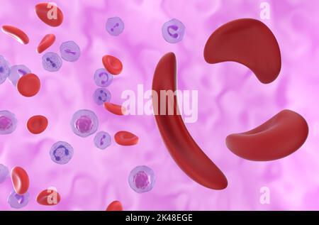 Anemia a cellule falciformi (malattia a cellule falciformi SCD) cellule nel flusso sanguigno - vista isometrica 3D illustrazione Foto Stock