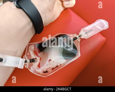 Donazione di sangue, trasfusione di sangue, controllo specificato, digiuno, assistenza sanitaria. Braccio sinistro di un giovane caucasico con attrezzature per donazioni di sangue o plasma Foto Stock