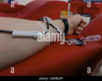 Donazione di sangue, trasfusione di sangue, controllo specificato, digiuno, assistenza sanitaria. Braccio sinistro di un giovane caucasico con attrezzature per donazioni di sangue o plasma Foto Stock