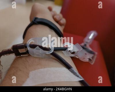 Donazione di sangue, trasfusione di sangue, controllo specificato, digiuno, assistenza sanitaria. Braccio sinistro di un giovane caucasico con attrezzature per donazioni di sangue o plasma Foto Stock