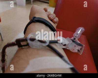 Donazione di sangue, trasfusione di sangue, controllo specificato, digiuno, assistenza sanitaria. Braccio sinistro di un giovane caucasico con attrezzature per donazioni di sangue o plasma Foto Stock