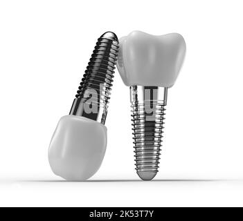 impianti dentali isolati su sfondo bianco. rendering 3d. Foto Stock