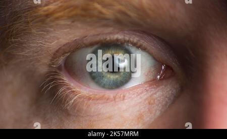 Primo piano di una palla occhio maschio completamente aperta. Foto Stock