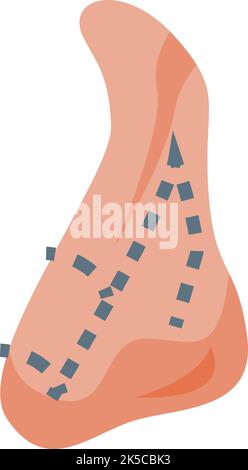 Rinoplastica Icon vettore isometrico. Chirurgia del naso. Apertura in plastica Illustrazione Vettoriale