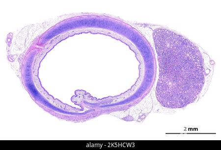 Micrografia al microscopio ottico a bassa potenza di una sezione trasversale della trachea, che mostra anelli tracheali a forma di C di cartilagine ialina. La mucosa tracheale è Foto Stock