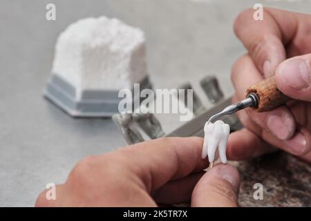 Dentista dentista uomo che lavora con dentiere nel suo laboratorio con cera, primo piano. Tecnico dentale modellante corone di denti con cera calda. Foto Stock