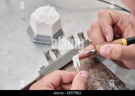 Dentista dentista uomo che lavora con dentiere nel suo laboratorio con cera, primo piano. Tecnico dentale modellante corone di denti con cera calda. Foto Stock