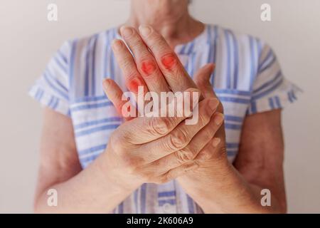 una donna anziana che soffre di dolore in mano sfrega il polso, primo piano Foto Stock