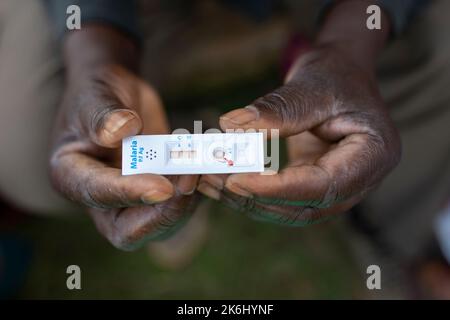 Un paio di mani tiene un test rapido positivo sulla malaria in Uganda, Africa orientale. Foto Stock