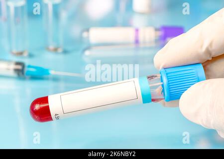 primo piano mano di un medico che tiene una provetta di analisi del sangue con etichetta vuota mock up su sfondo blu, spazio copia Foto Stock