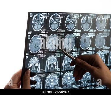 Una dottoressa esamina una risonanza magnetica del cervello. Foto Stock