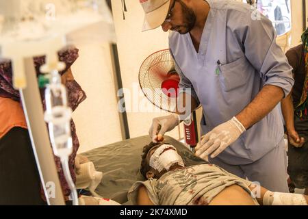 Juillet 2017 - Syrie - Rojava - Syrie du Nord - Camp de luoghi d'Ain Issa / Clinique MSF / un sirien originaire de Raqqa a eu un incidente de mobylette hors du camp. Les medecins interviennent aussi vite, le soignant de toute part Foto Stock