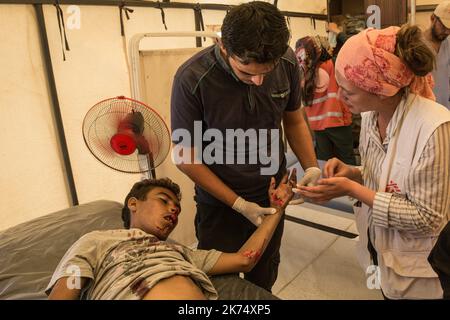 Juillet 2017 - Syrie - Rojava - Syrie du Nord - Camp de luoghi d'Ain Issa / Clinique MSF / un sirien originaire de Raqqa a eu un incidente de mobylette hors du camp. Les medecins interviennent aussi vite, le soignant de toute part Foto Stock