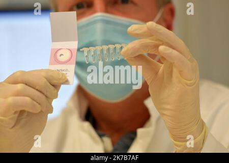 ©PHOTOPQR/LA DEPECHE DU MIDI/NATHALIE SAINT-AFFRE ; TOULOUSE ; 28/09/2020 ; AXIOTIS CONCEPT DE TEST COVID A DOMICILE TOULOUSE FRANCE SEPT 2020 AXIOTIS HOME COVID TEST CONCEPT Foto Stock