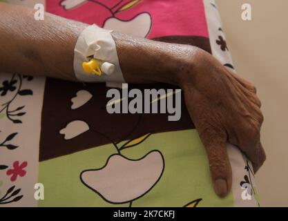 ©Abhisek Saha / le Pictorium/MAXPPP - Abhisek Saha / le Pictorium - 03/02/2021 - Inde / Tripura / Agartala - Des patients atteints de cancer sont traites dans un hopital pour cancereux a la veille de la Journee mondiale du cancer, a Agartala. La Journee mondiale contre le cancer est une journee internationale celebrree le 4 fevrier pour sensibiliser au cancer et encourager sa preventivation, sa detection et son traitement. / 03/02/2021 - India / Tripura / Agartala - i malati di cancro vengono curati in un ospedale oncologico alla vigilia della Giornata Mondiale del cancro ad Agartala. La Giornata Mondiale del cancro è una giornata internazionale Foto Stock