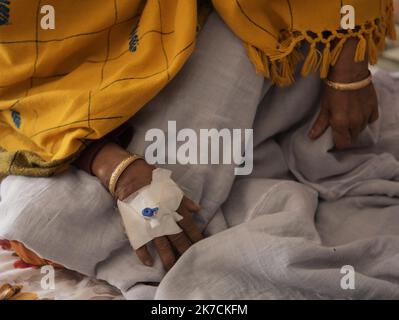 ©Abhisek Saha / le Pictorium/MAXPPP - Abhisek Saha / le Pictorium - 03/02/2021 - Inde / Tripura / Agartala - Des patients atteints de cancer sont traites dans un hopital pour cancereux a la veille de la Journee mondiale du cancer, a Agartala. La Journee mondiale contre le cancer est une journee internationale celebrree le 4 fevrier pour sensibiliser au cancer et encourager sa preventivation, sa detection et son traitement. / 03/02/2021 - India / Tripura / Agartala - i malati di cancro vengono curati in un ospedale oncologico alla vigilia della Giornata Mondiale del cancro ad Agartala. La Giornata Mondiale del cancro è una giornata internazionale Foto Stock