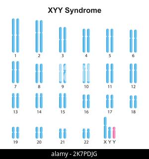 Progettazione scientifica della sindrome di Jacobs (XYY) Karyotype. Simboli colorati. Illustrazione vettoriale. Illustrazione Vettoriale