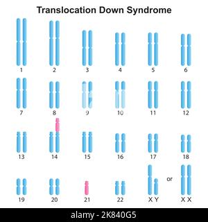 Progettazione scientifica della traslocazione Robertsonian Down Syndrome Karyotype. Simboli colorati. Illustrazione vettoriale. Illustrazione Vettoriale